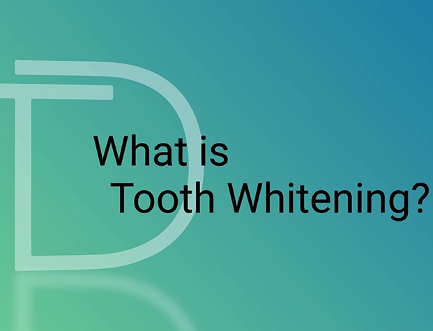 Text that reads what is tooth whitening