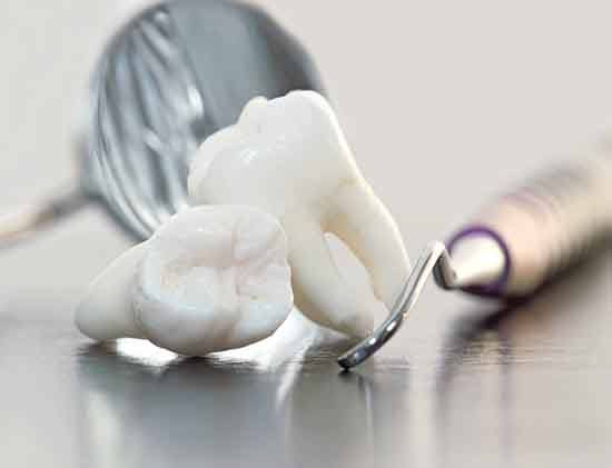 2 extracted molars on a table next to dental instruments